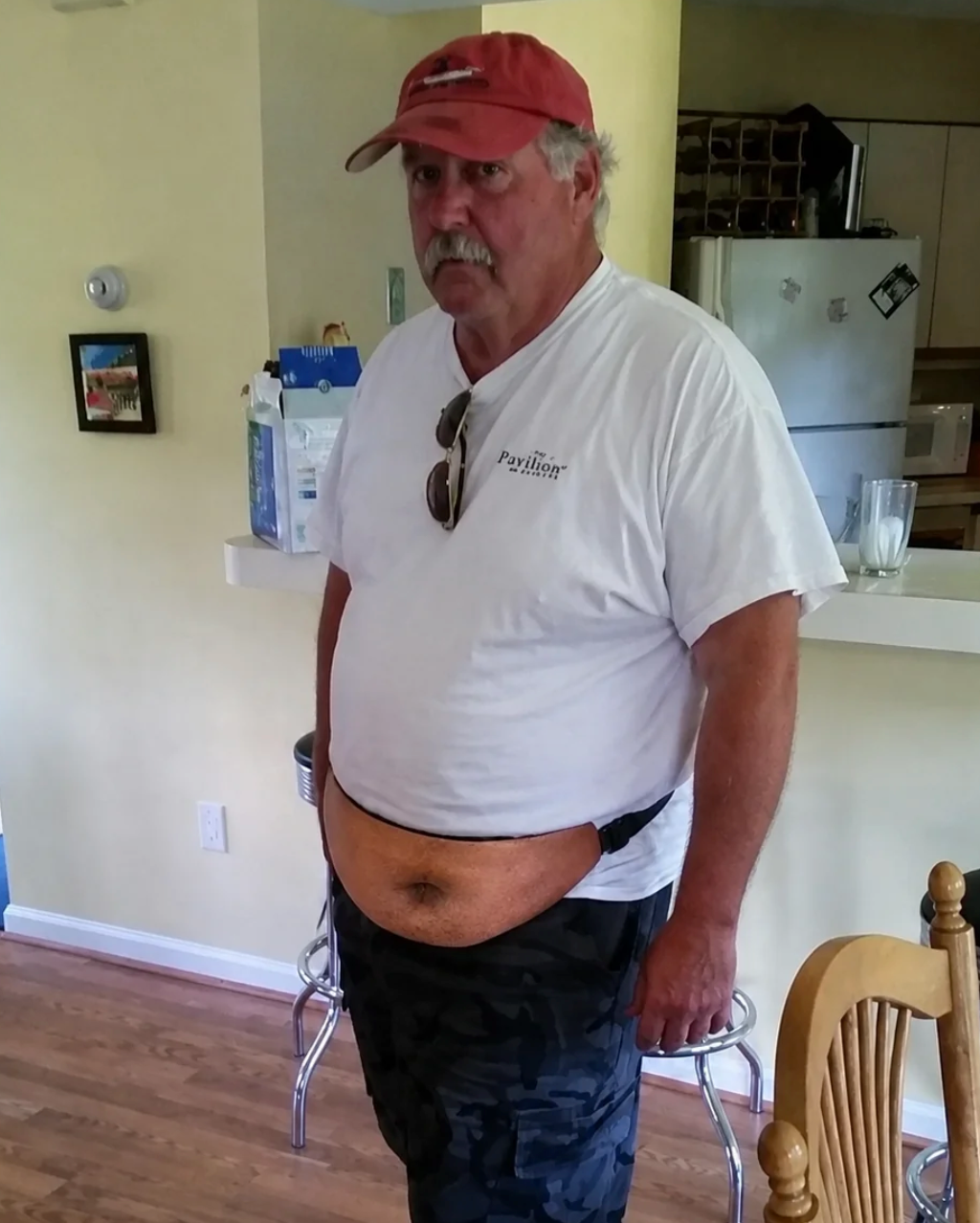 Belly Pack